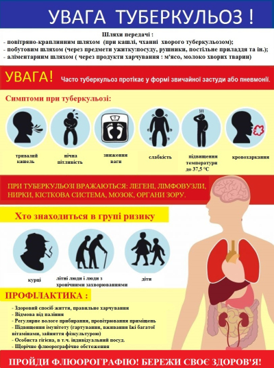 ТАК! МИ МОЖЕМО ПОДОЛАТИ ТУБЕРКУЛЬОЗ!